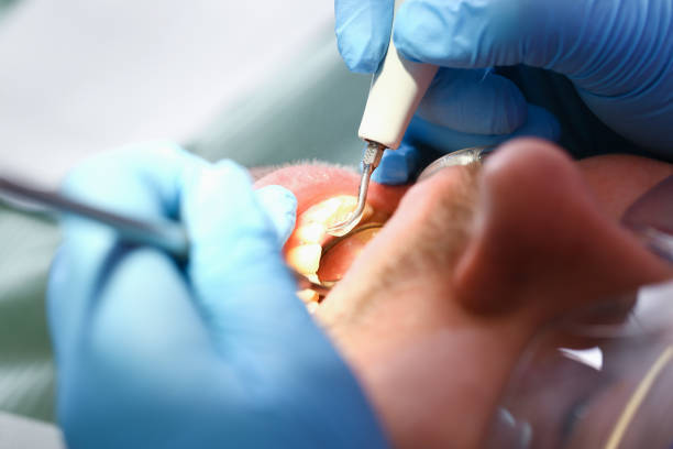 Best Emergency Cosmetic Dentistry (e.g., broken veneers) in El Cerro Mission, NM