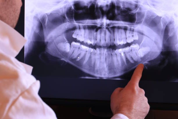 Best Broken or Chipped Tooth Repair in El Cerro Mission, NM