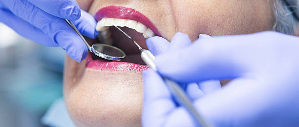 Best Broken or Chipped Tooth Repair in El Cerro Mission, NM