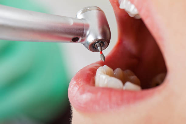 Best Walk-In Emergency Dental Services in El Cerro Mission, NM
